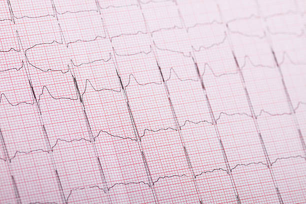 электро-encephalogramme - pulse trace computer monitor eeg equipment стоковые фото и изображения