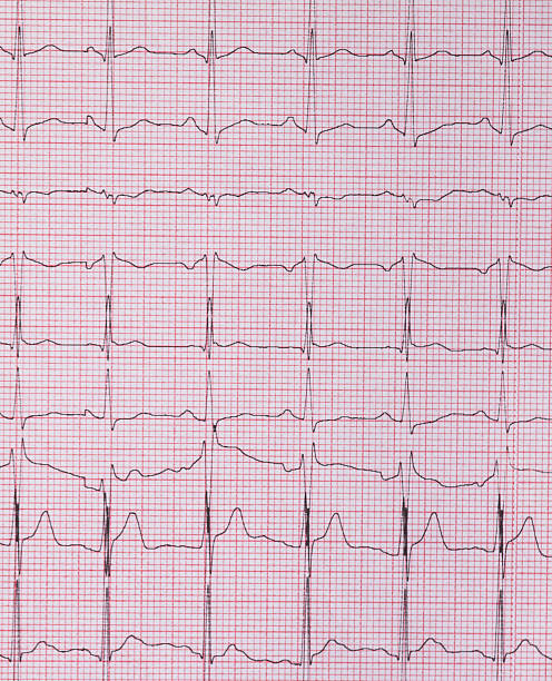 electro-encephalogramme - pulse trace computer monitor eeg equipment imagens e fotografias de stock