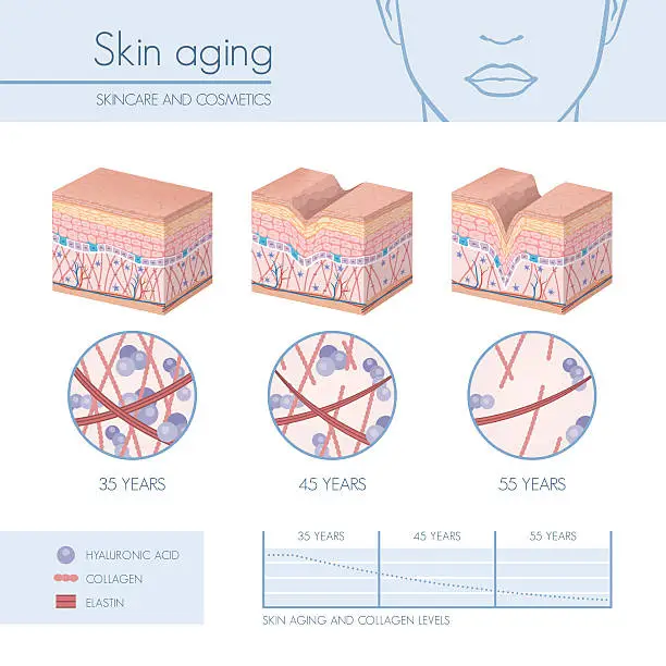 Vector illustration of Skin aging