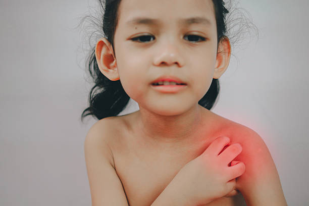 istock young girl scratch the itch with hand ,neck, itching. 613341588