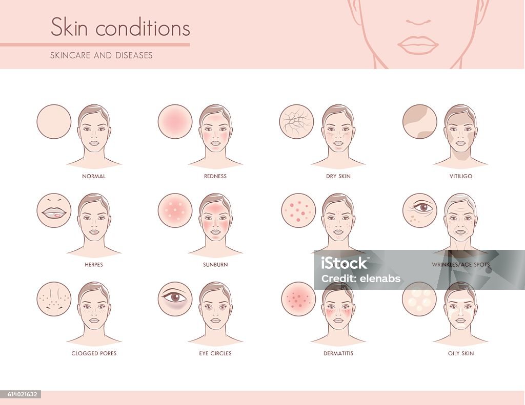 Skin conditions Skin conditions and problems, skincare and dermatology concept Human Face stock vector