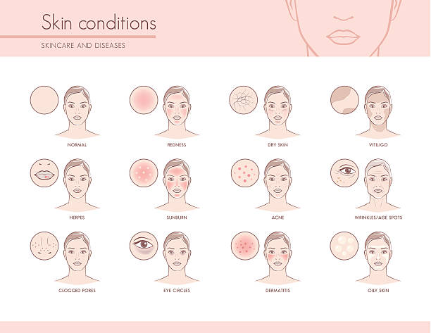 Skin conditions Skin conditions and problems, skincare and dermatology concept aging process illustrations stock illustrations