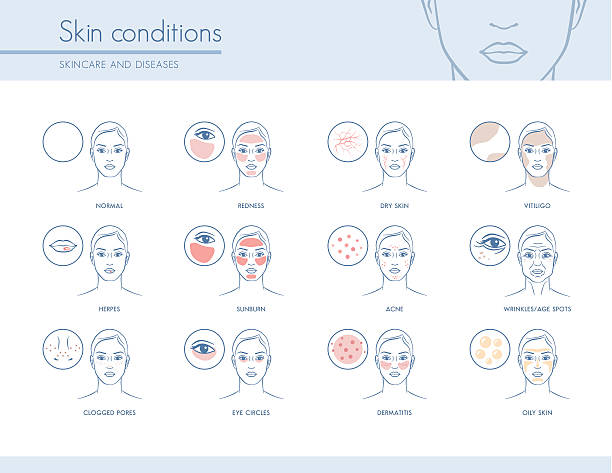 Skin conditions Skin conditions and problems, skincare and dermatology concept vitiligo stock illustrations
