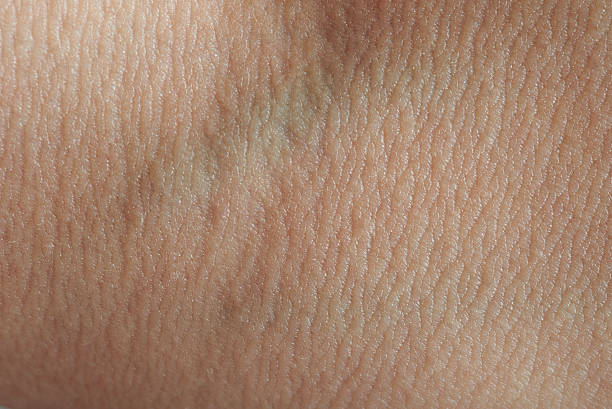 istock macro of blood vein 614112400