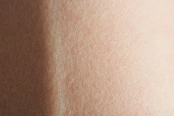 istock close up of vein 614114940