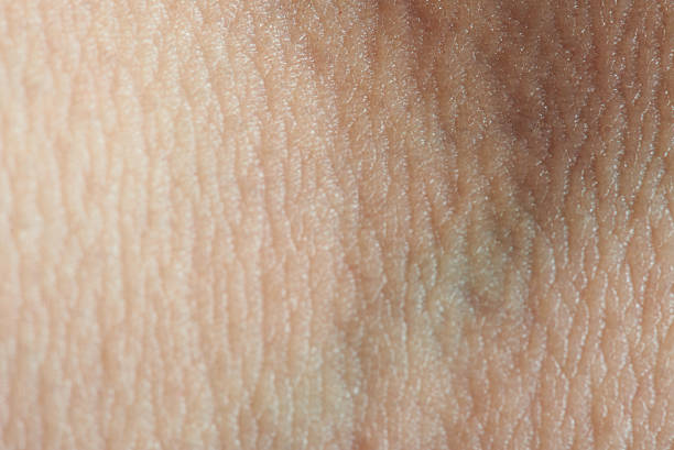 istock texture of skin with vein 614118252