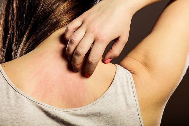 primer plano de mujer rascarse la espalda - itchy skin fotografías e imágenes de stock