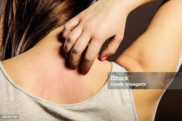 Woman Scratching Her Back Closeup Stock Photo - Download Image Now - Scratching, Women, Allergy