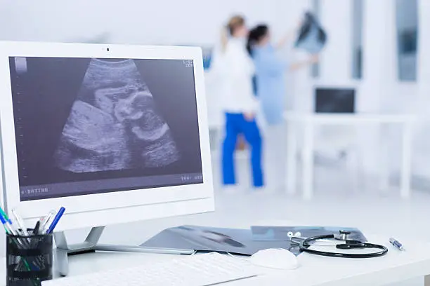 Close-up of a white monitor with pregnancy ultrasound displayed on it