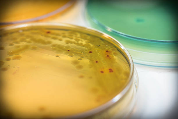 istock Bacterial colonies culture on MacConkey agar media(Pseudomonas a 614240600