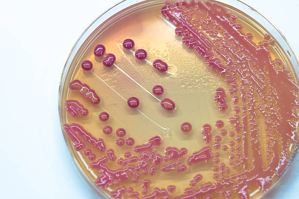 colônias bacterianas cultura crescimento em ágar macconkey (ágar mac). - bacterium colony laboratory pus - fotografias e filmes do acervo