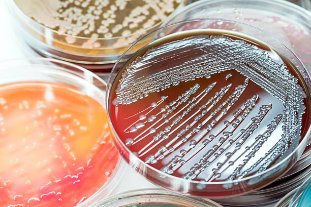 istock Bacterial culture growth on selective media. 614242694