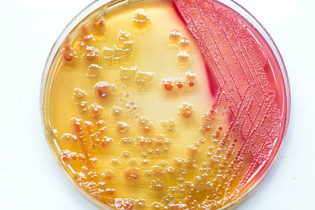 bakterienkulturwachstum auf macconkey agar (gram negative bacill - blood agar stock-fotos und bilder