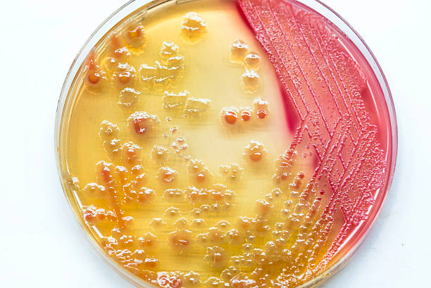 Bacterial culture growth on MacConkey agar (Gram negative bacill stock photo
