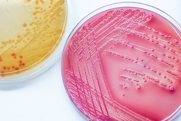 istock Bacterial culture growth on MacConkey agar media (Escherichai co 614243356