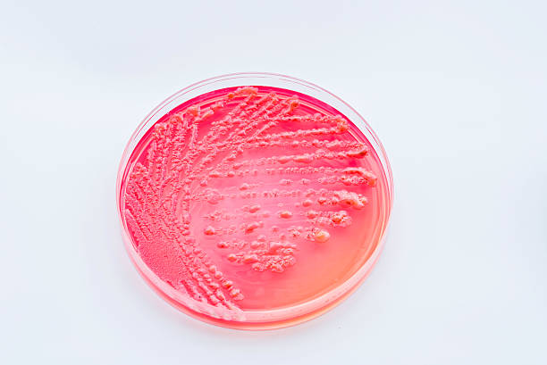istock Bacterial colonies culture on  Differential and Selective media 614317296