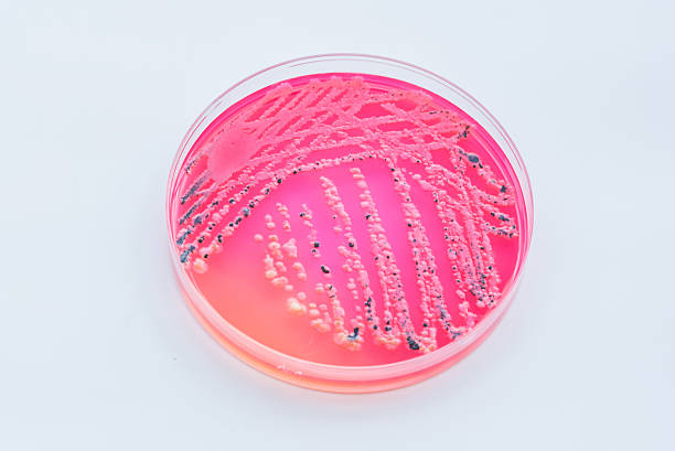 Bacterial colonies culture on  Differential and Selective media stock photo