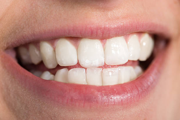 istock Woman Showing Healthy White Teeth 614444018