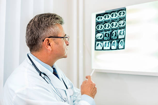 istock Doctor examining MRI scan 614723984