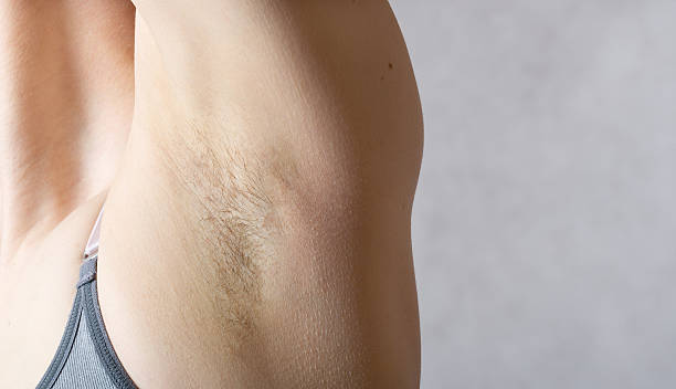 istock Underarm hair before depilation. Closeup 614725110