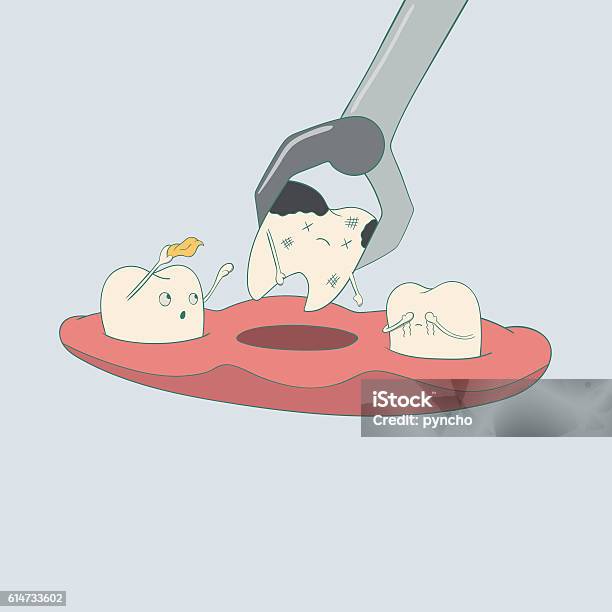 Tooth Extration Cartoon Tooth Dental Extraction And Removal Stock Illustration - Download Image ...