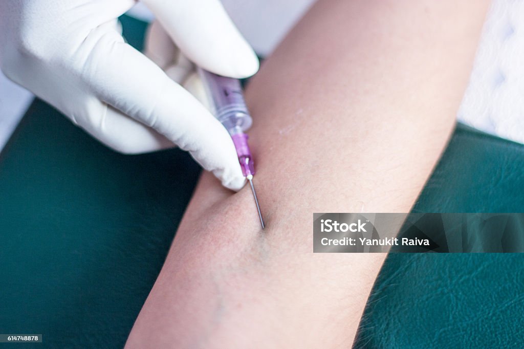 pin in arm for blood test close up pin in arm syringe pumping blood for test in hospital Care Stock Photo