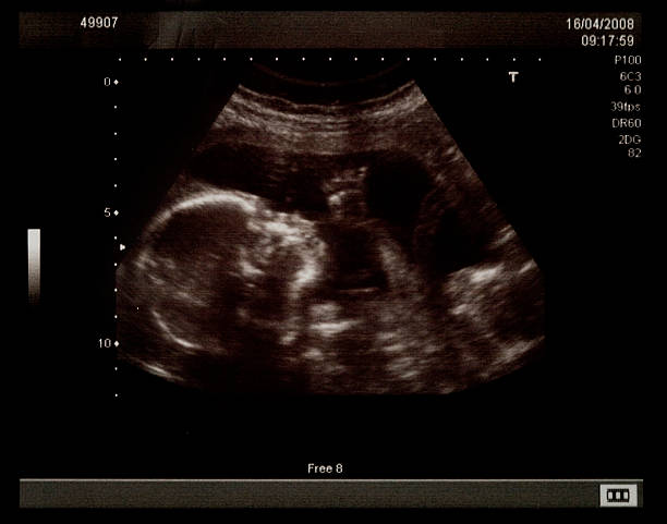 istock Baby ultrasound picture 614960452