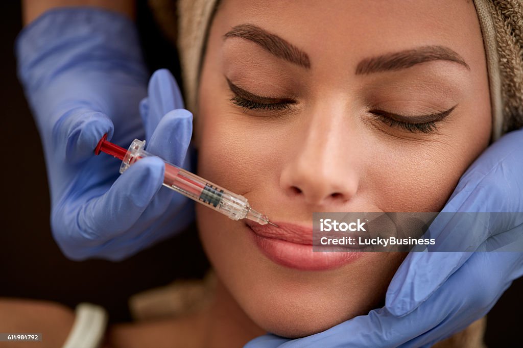 Lippen erhöhen - Lizenzfrei Arzt Stock-Foto