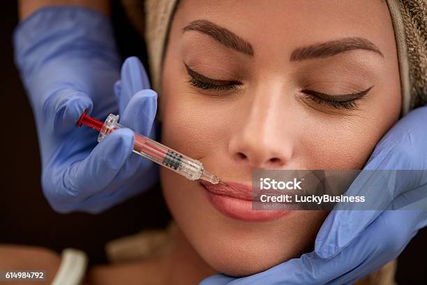Lippen Erhöhen Stockfoto und mehr Bilder von Arzt - Arzt, Botulinumtoxin-Spritze, Chirurgienadel