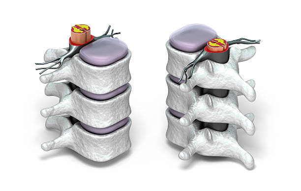 coluna humana em detalhes: vértebra, medula óssea, disco e nervos. - human vertebra - fotografias e filmes do acervo