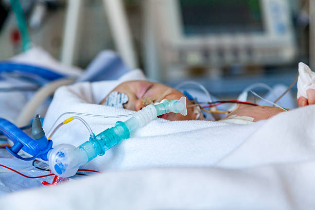 primer plano, niño en la unidad de cuidados intensivos después de la cirugía. - ventilador equipo respiratorio fotografías e imágenes de stock