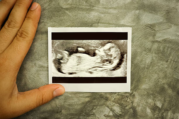 istock Ultrasound Scan Photo in concrete wall babkground 615392074