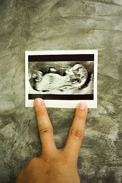 istock Ultrasound Scan Photo in concrete wall babkground 615392076