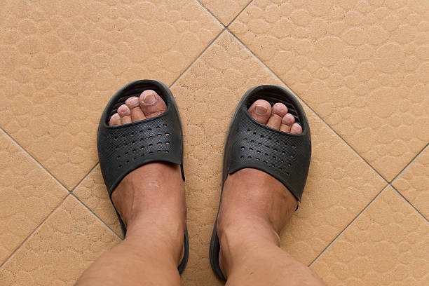 istock foot in damage sandals on floor 615616630