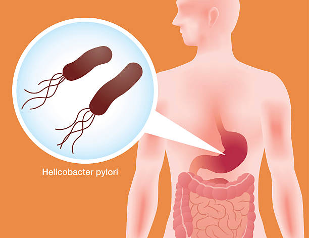 ilustraciones, imágenes clip art, dibujos animados e iconos de stock de estómago humano y helicobacter pylori - pylori