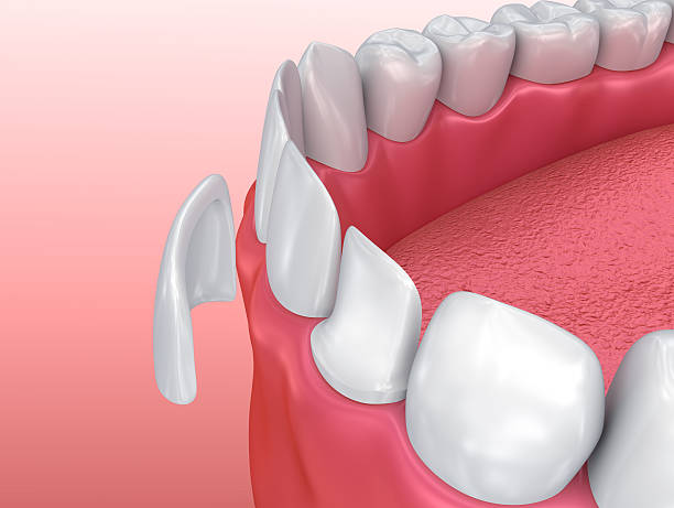 folheados de dentista - recreate imagens e fotografias de stock