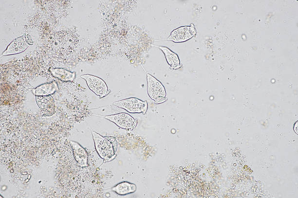 living vorticella is a genus of protozoan under microscop view. - microscop imagens e fotografias de stock