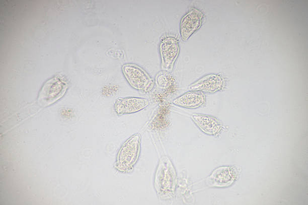 vorticella is a genus of protozoan under microscop view. - microscop imagens e fotografias de stock