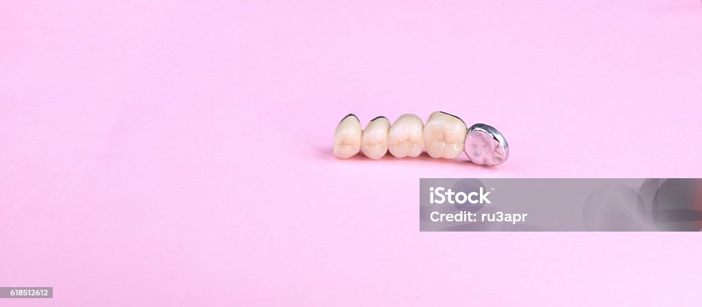 dental prosthesis on pink background Artificial Stock Photo