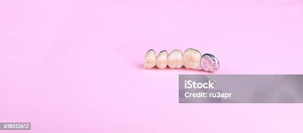 Dental Prosthesis On Pink Background Stock Photo - Download Image Now - Artificial, Backgrounds, Chrome