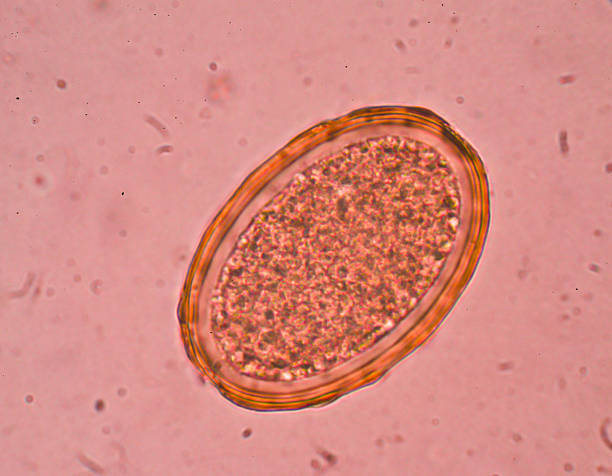 istock Egg of Parasitic nematode worm (roundworm) Ascaris lumbricoides 618537158