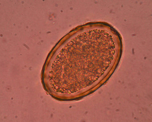istock Egg of Parasitic nematode worm (roundworm) Ascaris lumbricoides 618537244