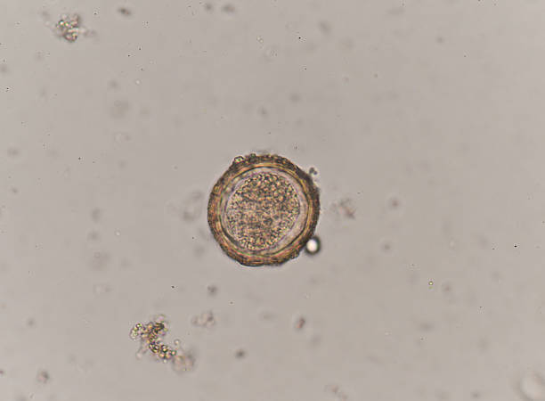 istock Egg of Parasitic nematode worm (roundworm) Ascaris lumbricoides 618537374