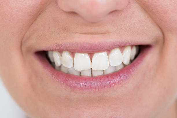 istock Female Smiling With Healthy White Teeth 618555560