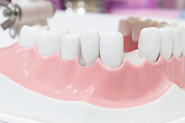 istock Closeup Dental Model of Teeth  dentist. 618763630