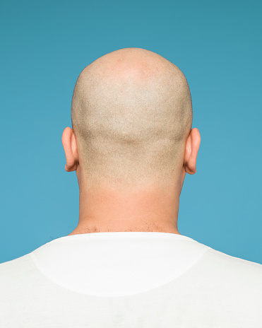 Back view of young man with bald head.Back of model's head is seen.The background is blue.Both ears are in view.Shot with medium format camera Hasselblad in studio.Top of head is completely bald while other parts are shaved. Shot in horizontal framing then edited to square.