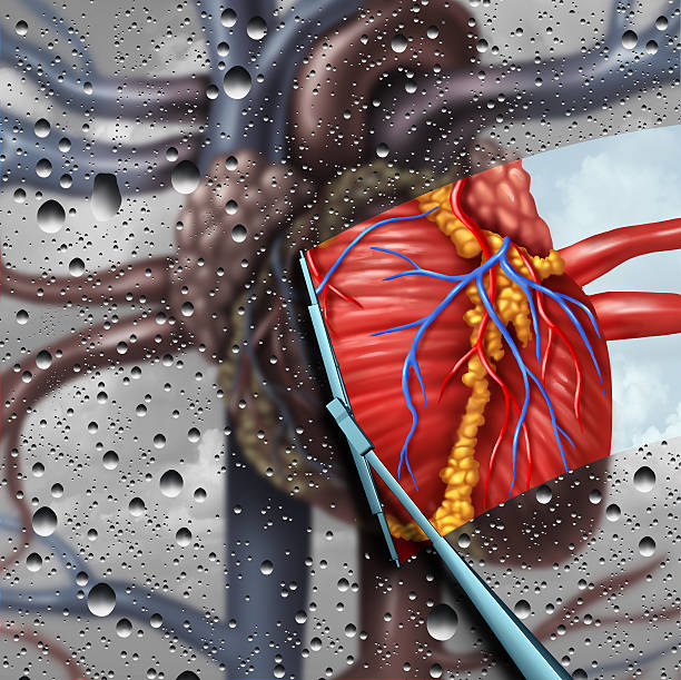 인간 심장 질환 치료 - left ventricle 뉴스 사진 이미지