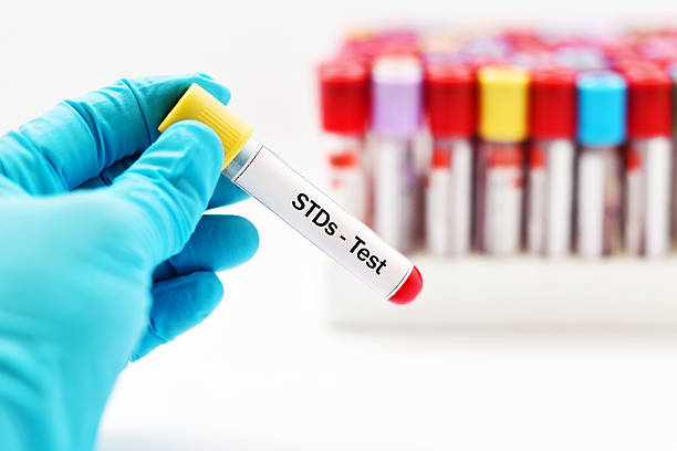 STDs Test Blood sample for STDs (sexually transmitted diseases) test sexually transmitted disease stock pictures, royalty-free photos & images