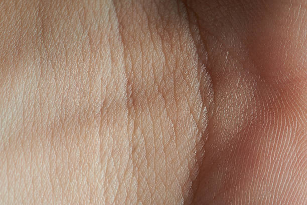 istock skin on join of hand 619644280