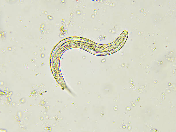 istock Strongyloides stercoralis (threadworm) 619762770